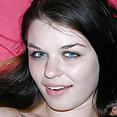 Sunburnt Teen - image control.gallery.php